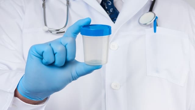 Doctor Holding Urine Drug Test